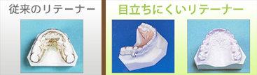 従来のリテーナーとリテーナー