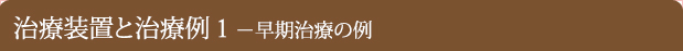 最新の装置と治療例2